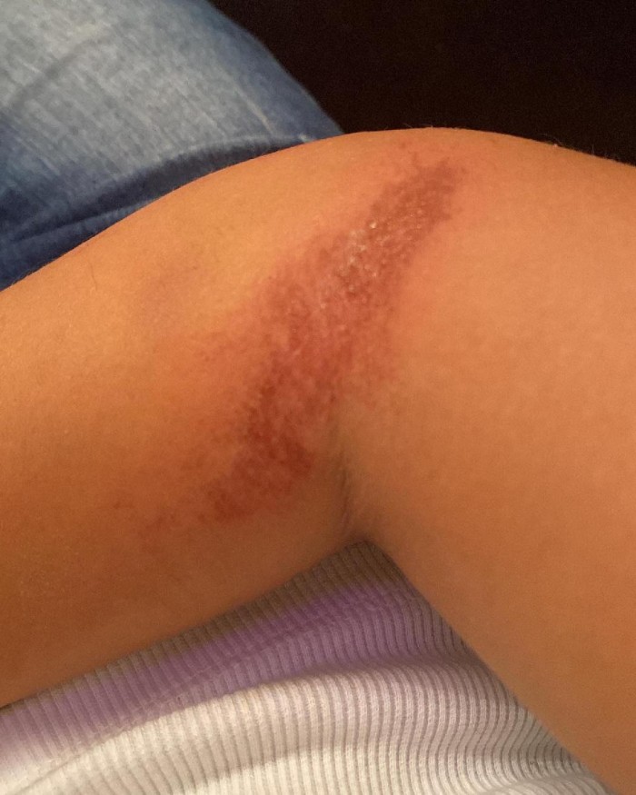 Bloger ərinin voleybolçu sevgilisi tərəfindən döyülüb - İDDİA  (FOTOLAR)